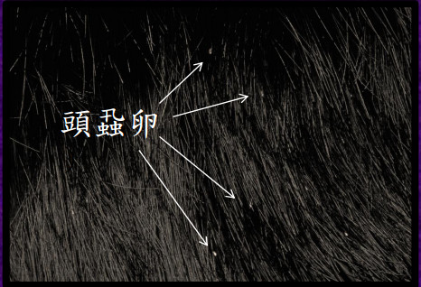 頭發(fā)上有管狀附著物怎么去除 發(fā)鞘是什么
