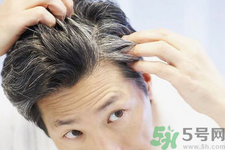 年輕人長白頭發怎么辦？年輕人長白頭發是什么原因？