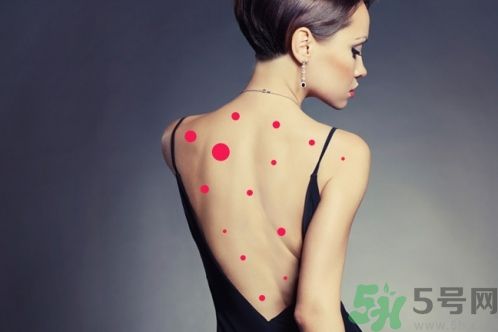 背上為什么會長痘痘？長痘痘怎么辦？