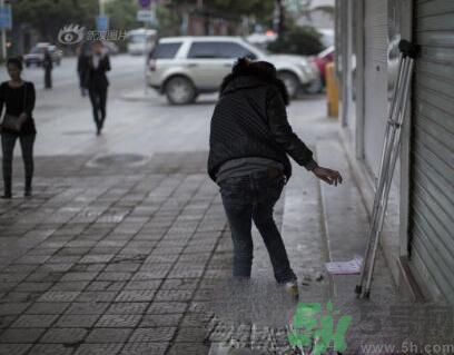 學生患東方美女病是怎么回事？東方美女病是什么病？