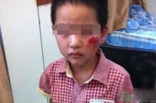 男孩遭校長暴打的結果是什么？男孩遭校長暴打的真相是什么？