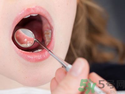早上起床嘴苦是怎么回事？嘴苦怎么調理？