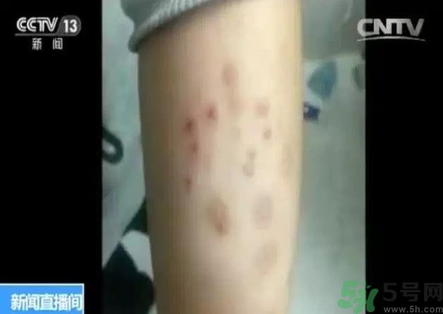 被污染學(xué)校是哪個？500師生患病的原因？