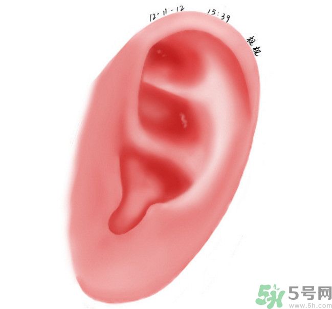 耳石脫落導(dǎo)致的眩暈怎么辦？耳石癥暈眩能自愈嗎？