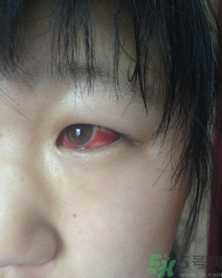 初中生全體甲醛中毒是怎么回事？初中生全體甲醛中毒是哪個學校？