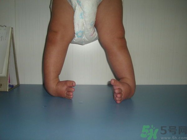 女生3天花8萬是怎么回事？馬蹄足是什么病？