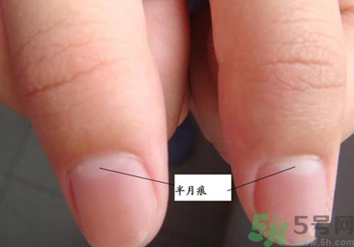 指甲沒有月牙是什么原因？指甲沒有月牙怎么調(diào)理？