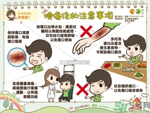手被油燙傷了怎么處理？手被油燙起泡了怎么辦？