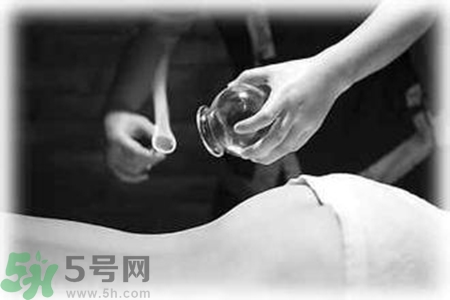 大暑可以拔罐嗎？大暑拔罐好不好？