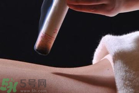 大暑可以艾灸嗎？大暑艾灸的好處有哪些？