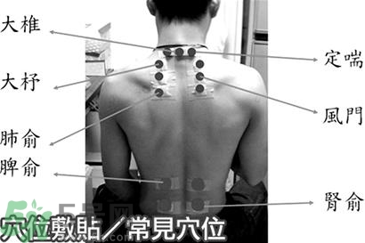 經(jīng)期可以貼三伏貼嗎？來月經(jīng)可以貼三伏貼嗎？