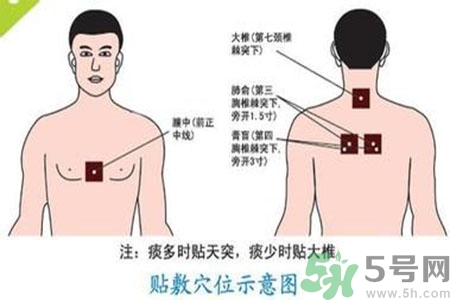 三伏貼能治頸椎病嗎？頸椎病三伏貼穴位