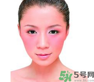 敏感性皮膚用什么洗面奶？敏感性皮膚怎么修復(fù)？