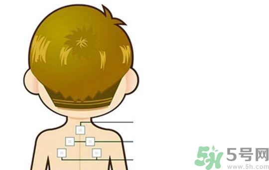 貼三伏貼可以吹空調(diào)嗎？貼完三伏貼多久后可以吹空調(diào)？