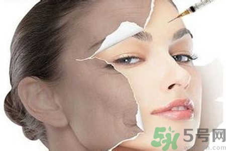 美白針效果怎么樣？美白針有副作用嗎？