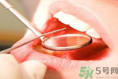 冷光美白牙齒是什么？冷光美白牙齒的好處有哪些？