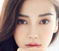 開眼角會留疤嗎？開眼角增生怎么辦？