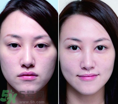 臥蠶是什么？臥蠶是眼袋嗎？