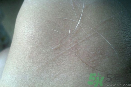 生完寶寶白頭發的原因？生完寶寶白頭發怎么辦？