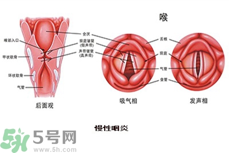 慢性咽炎是什么？慢性咽炎的癥狀有哪些？