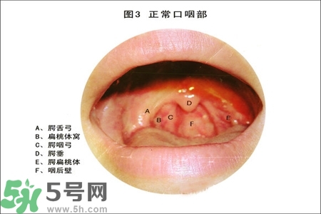 慢性咽炎的治療方法?慢性咽炎的藥物治療? 慢性咽炎的治療方法?慢性咽炎的藥物治療?