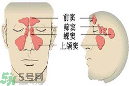 鼻竇炎是什么？鼻竇炎的癥狀有哪些？