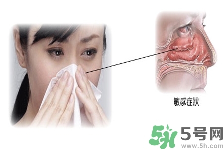 過敏性鼻炎的高發(fā)人群有哪些？如何預防過敏性鼻炎？