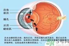 青光眼是什么？青光眼癥狀有什么？