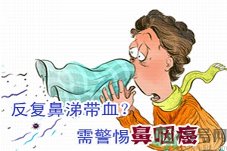鼻咽癌是什么？鼻咽癌的癥狀有哪些？