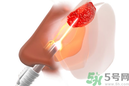 鼻咽癌的日常措施是什么？鼻咽癌注意的飲食有哪些？