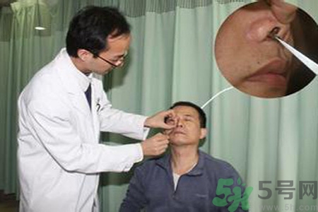鼻咽癌的治療方法是什么？鼻咽癌可以用什么藥物治療？