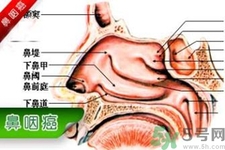 鼻咽癌的發(fā)病因素是什么？鼻咽癌的并發(fā)癥有哪些？