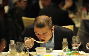 男人禿頂會(huì)遺傳嗎？男人禿頂是腎虛嗎？