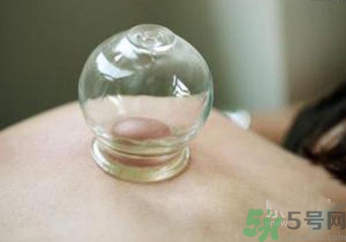 拔火罐和拔氣罐哪個好？拔火罐和拔氣罐的區別
