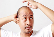 脫發的高發人群有哪些？如何預防脫發？