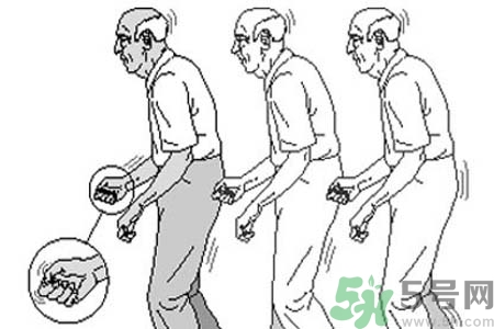 帕金森要注意哪些措施？帕金森的飲食需注意什么？
