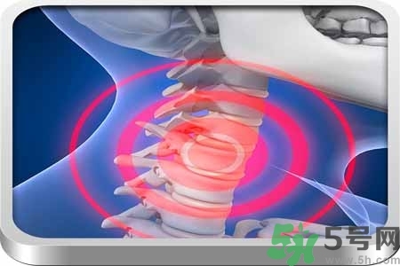 為什么年輕人容易得頸椎病？頸椎病嚴重的癥狀有哪些？