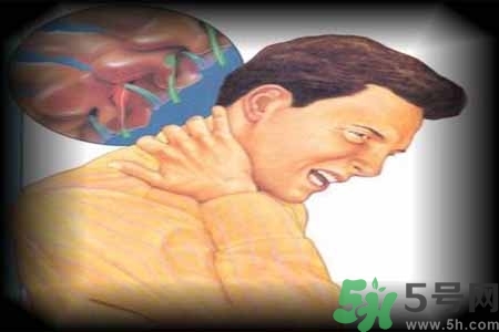 為什么年輕人容易得頸椎病？頸椎病嚴重的癥狀有哪些？