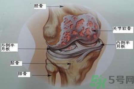 預防骨病需要注意哪些姿勢？秋季預防骨病的方法有哪些？