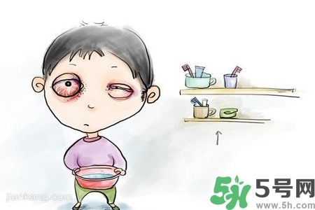 寶寶為什么會感染紅眼病？寶寶患紅眼病如何治療？