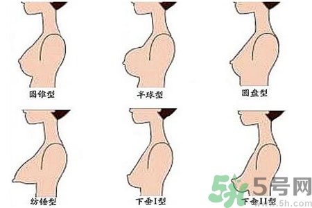 ?女性乳房下垂的原因是什么？女性乳房下垂的分類有哪些？
