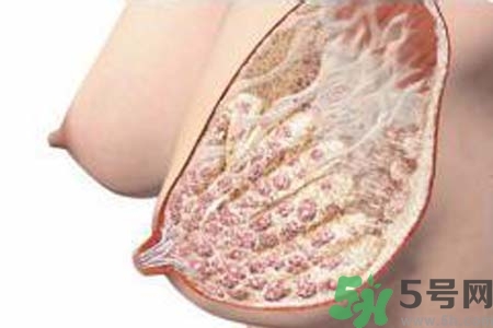乳腺增生治療方法是什么？乳腺增生的檢查方法有哪些？