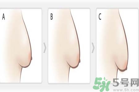 胸部松弛的原因是什么？胸部松弛該怎么辦？