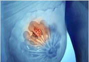 乳房有硬塊正常嗎？乳房有腫塊怎么回事？