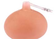 乳頭內(nèi)陷可以拔罐嗎？乳頭內(nèi)陷需要手術(shù)治療嗎？