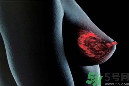 乳房上有硬塊怎么辦？乳房有硬塊的病因是什么？