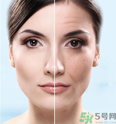 什么是3D液態(tài)拉皮？3D液態(tài)拉皮效果怎么樣？