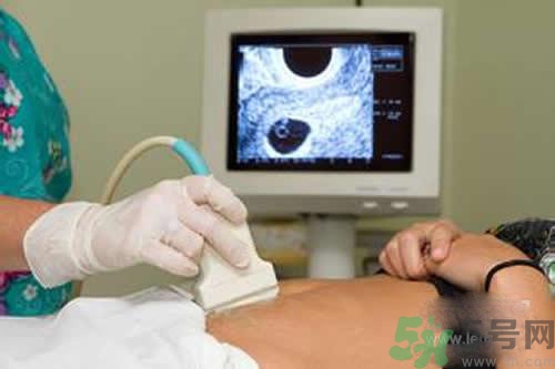 孕婦做b超要空腹嗎？孕婦做b超要不要空腹？