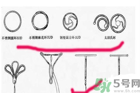什么是宮內(nèi)節(jié)育器？放置宮內(nèi)節(jié)育器為什么能避孕？
