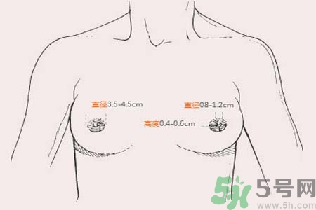 乳頭內陷能不能喂奶？乳頭凹陷怎樣哺乳？